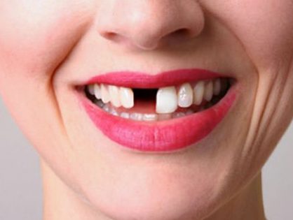 Mieux vaut prévenir que guérir