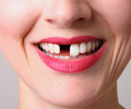 Mieux vaut prévenir que guérir